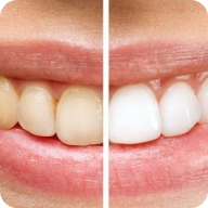 ¿Por qué mis dientes están amarillos si me cepillo todos los días?
