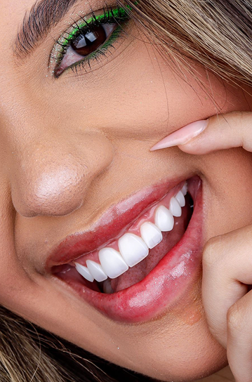 Blanqueamiento dental
